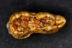 CAVERN BEAR TOOTH - Ursus spelaeus - Pléistocène  from  Europe.