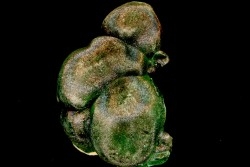 Malachite - Shilu Mine, Yangchun Co., Yangjiang, Guangdong Province, China